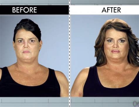 Flat Face From Botched Patients Before And After Shocking Transformations E News