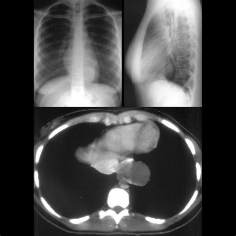 March 28 2019 Pediatric Imaging