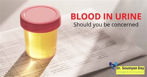 Blood In Urine Know The Causes Solutions Hematuria Treatment In India