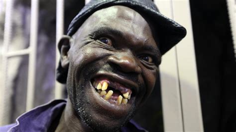 Brekkie Wrap Riot At Zimbabwes ‘mister Ugly Contest Over Who Is The Ugliest Man Gold Coast