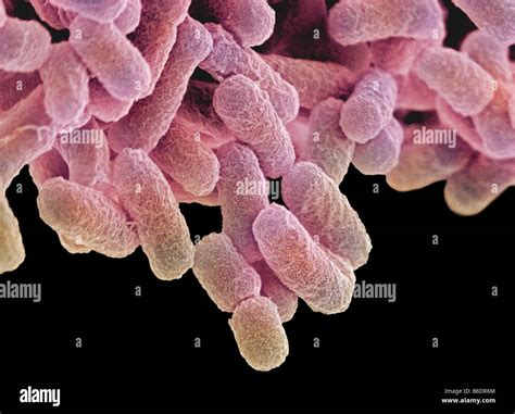 Escherichia Coli Are Gram Negative Rod Shaped Bacteria That Are Part Of