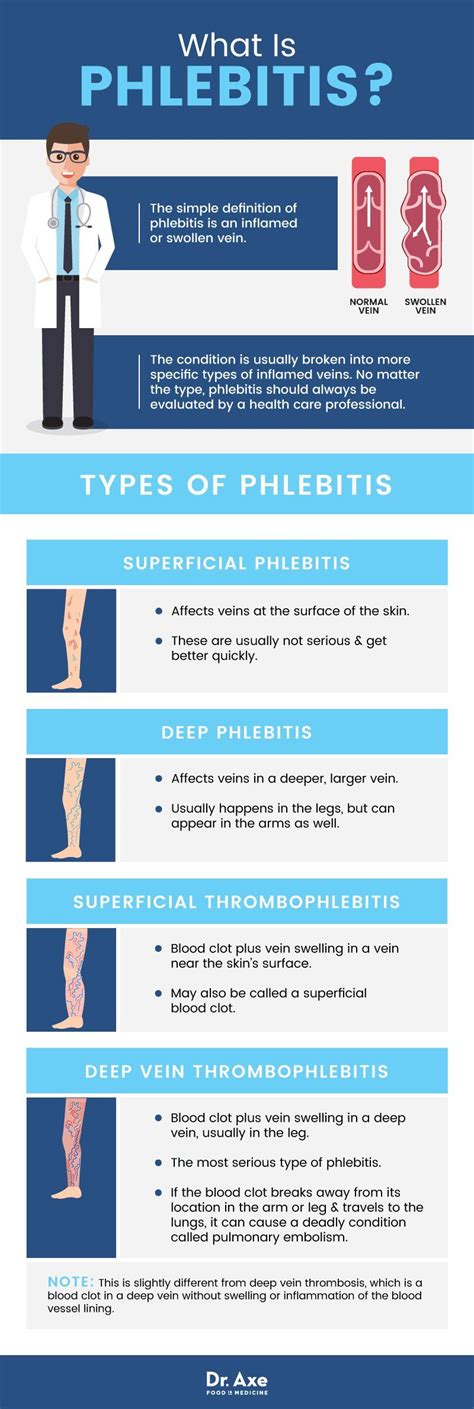 Phlebitis 5 Natural Ways To Improve Symptoms Dr Axe Phlebitis
