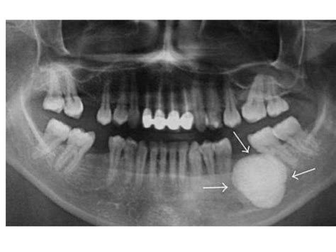 Practical Oral Radiology 2 2016