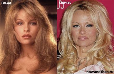 Celebrities Then And Now 75 Pics
