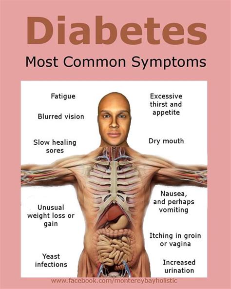Diabetes Type 2 Symptoms Blurred Vision Wilde Natural Remedies For