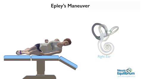 Epley Maneuver A Step By Step Guide To Treat Bppv Vertigo Youtube