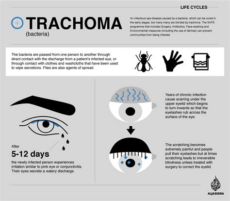 Life Cycle Trachoma Lifelines Al Jazeera