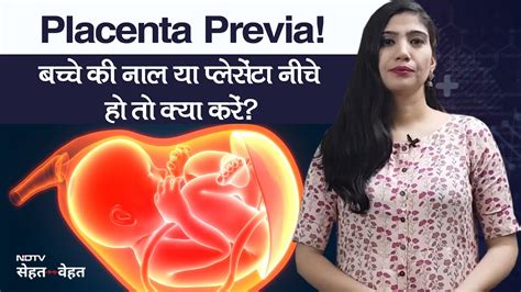 Low Lying Placenta Placenta Previa क्या है लॉ लाइंग प्लेसेंटाक्‍या