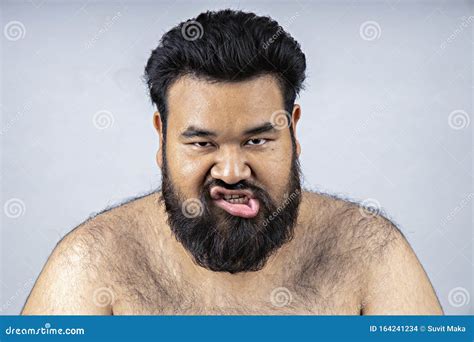 A Fat Man With A Shaggy Beard Stock Photo Image Of Hair Disease