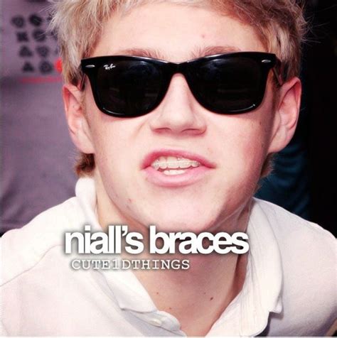 Niall Was Adorable Before Braces While He Had Braces And After Braces If U Think Hes Cute Just