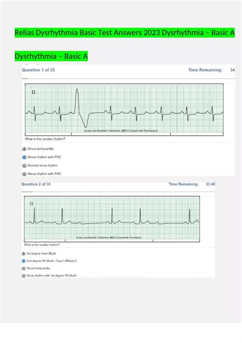 Relias Dysrhythmia Basic Test Answers 2023 Dysrhythmia – Basic A