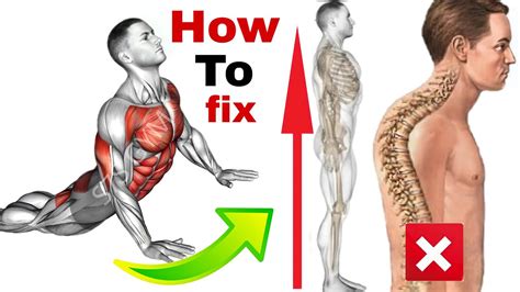 How To Fix An Arched Back💢back Arch Exercises Youtube