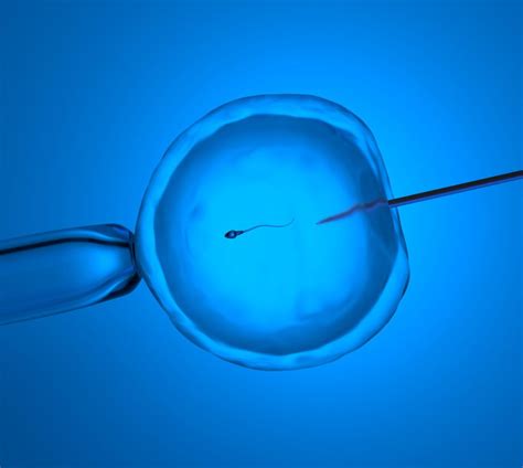 Intracytoplasmic Sperm Injection Icsi Sincere Healthcare Group