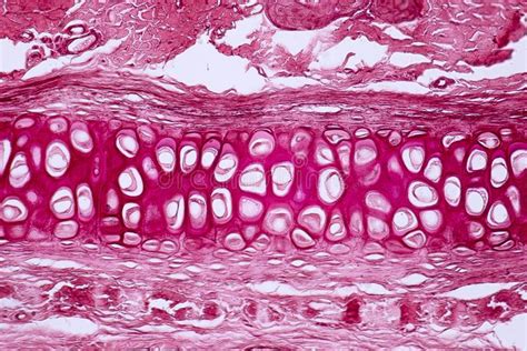 Sometimes referred to as 'spongy bone' or 'trabecular bone', cancellous bone is found within the middle of large bones. Cross Section Human Cartilage Bone Under Microscope View ...