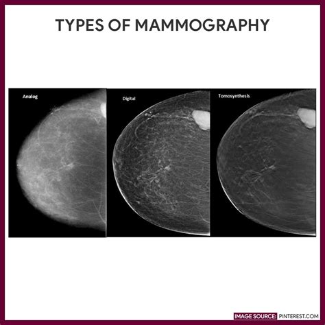 Understanding Your Mammogram Options Different Types Of Mammograms For