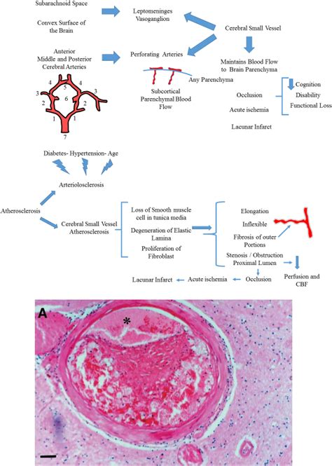 Cerebral Small Vessel Disease Qian Li Yang Yang Cesar Reis Tao Tao