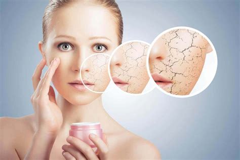 Dry Skin Care How To Get Rid Of Dry Skin Milliontalks