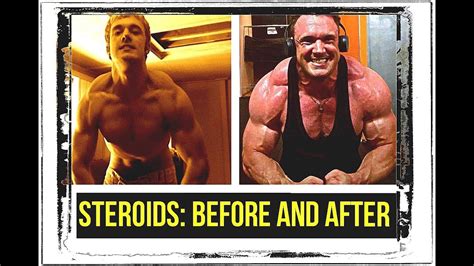 Steroid Transformation Before And After Youtube