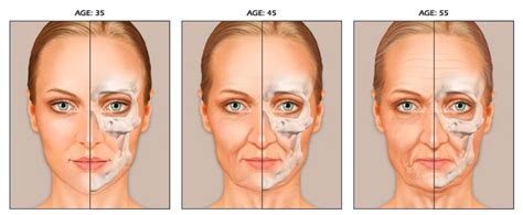 Dermasphere Anatomy Of An Aging Face