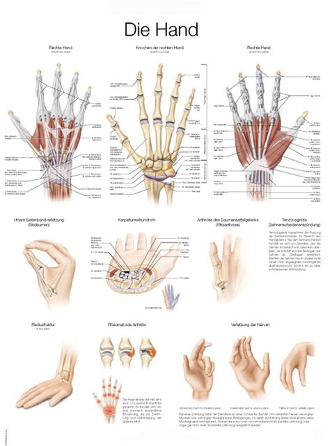 Anatomical Chart Hand