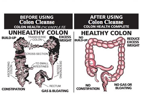 Colon Cleansing How To Spring Clean Your Body