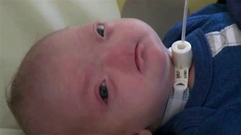 Adorable Baby Born Without A Nose Abc13 Houston
