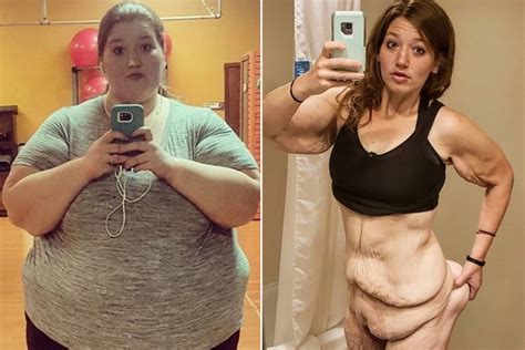 Couple Embarks On A Thrilling Weight Loss Journey