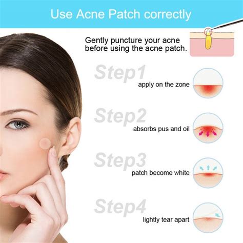 Best Hydrocolloid Blemish Treatment Acne Patches For Skin Care