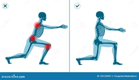 Wrong And Correct Lunges Exercise Right Execution Technique Of Sport