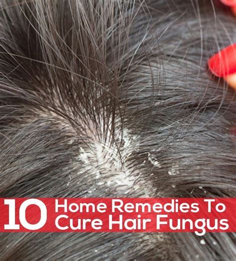 How To Get Rid Of Fungal Scalp Infection 8 Natural Remedies Home