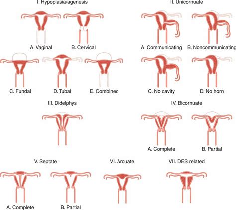 Congenital Genitourinary Abnormalities Williams Obstetrics Th Edition