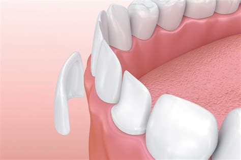 Trata Odontología Conservadora Clínica Sol Dental