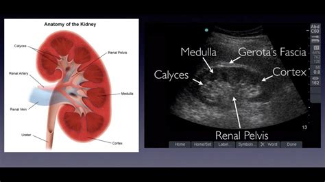Introduction To Renal Ultrasound Youtube
