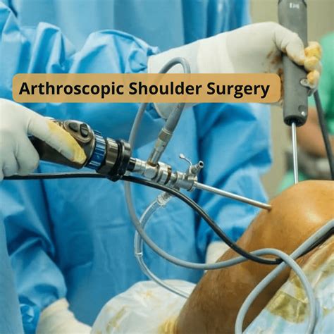 Arthroscopic Shoulder Surgery Fast Recovery Smaller Scars Dr Amyn