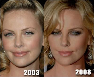 Charlize Theron Plastic Surgery Charlize Theron Pictures