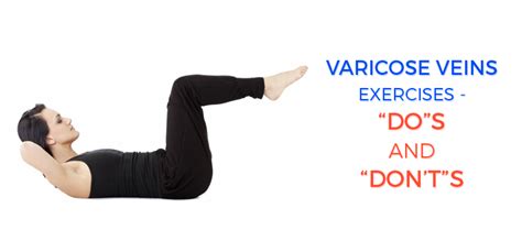 Exercising Varicose Veins The Dos And Donts Karishma