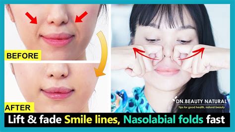 Best 6 Exercises To Lift Smile Lines Reduce Nasolabial Folds Fix
