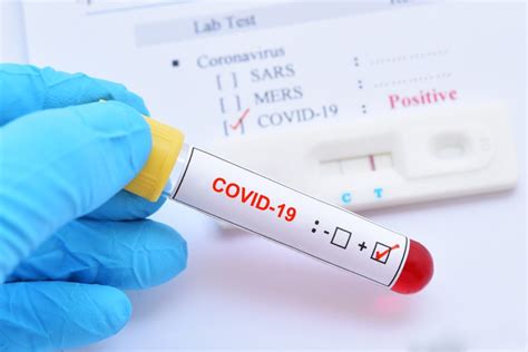Virus tests and antibody tests. Corona-Test - Wie? Wann? Wo? - thyssenkrupp Encasa