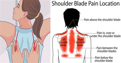 Shoulder blade pain can be felt anywhere along the tops of the shoulders and the back plane of the body. Pain Between Shoulder Blades = Cancer??