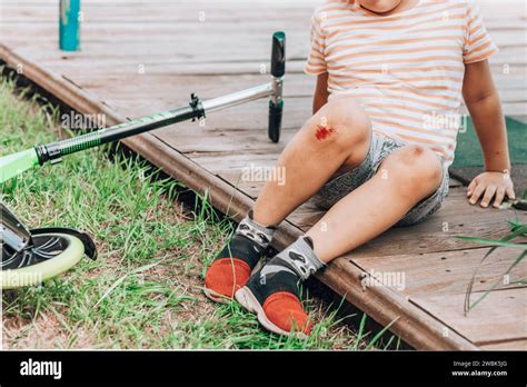 A Close Up Of A Childs Leg Injury The Child Injured His Knee When He