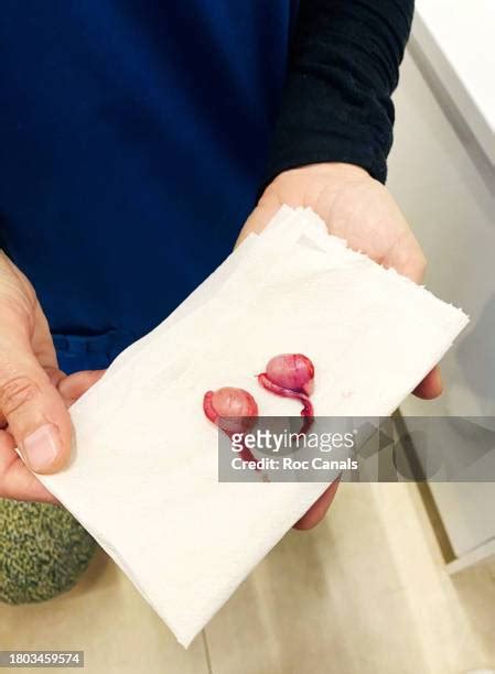 Human Castration Photo Photos And Premium High Res Pictures Getty Images