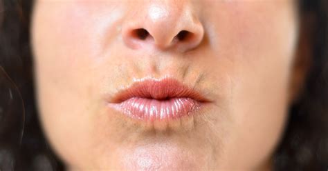 Treatments For Smokers Lips Melior Clinics