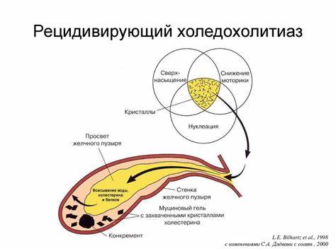 Диета после холецистэктомии через год