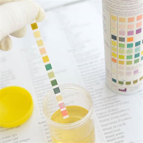 Complete Urinalysis In Calgary Tests Integrative Health