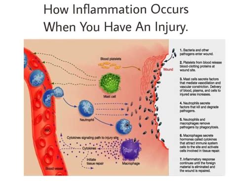 What Causes Inflammation Inflammation Occurs After You Have An Injury
