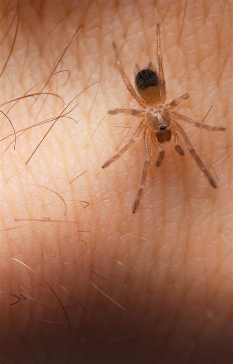 Signs And Symptoms Of A Poisonous Spider Bite University Of Utah