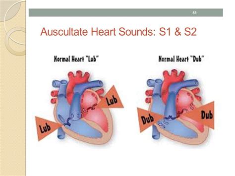 The Heart Sounds Online Presentation