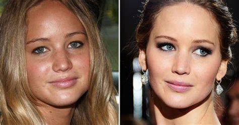 Jennifer Lawrence Had Plastic Surgery After Seeing These Before And After Photos