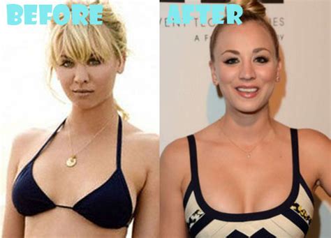 Kaley Cuoco Plastic Surgery Before And After Boob Job