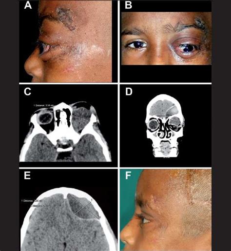 A And B Clinical Photograph Of The Patient Showing The Nonaxial